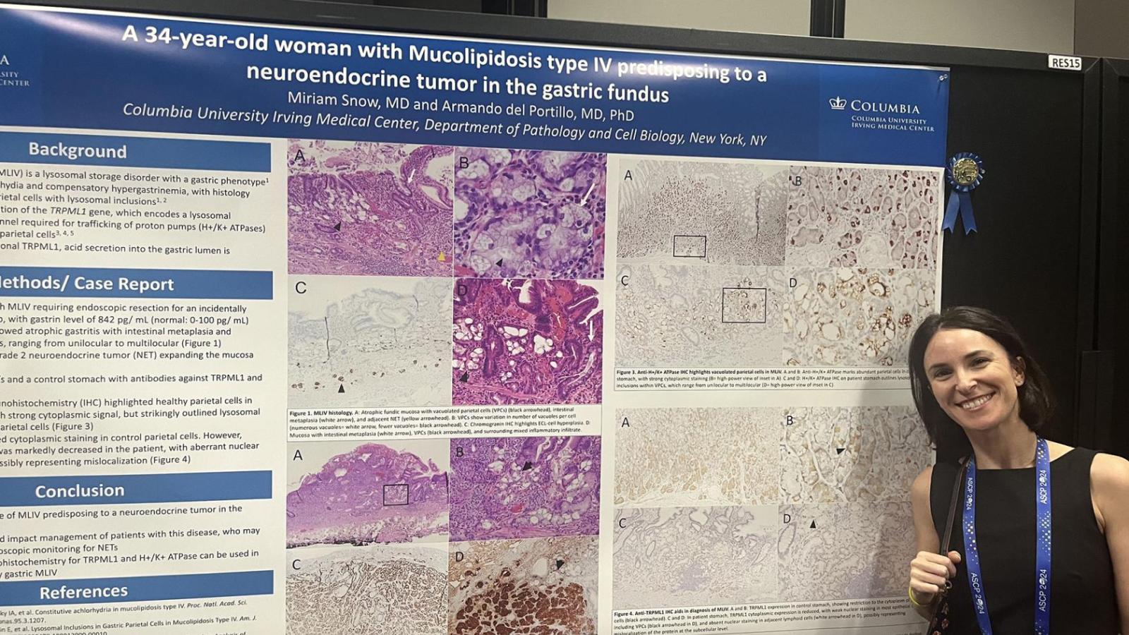 Miriam blue ribbon - CUIMC Pathology and Cell Biology