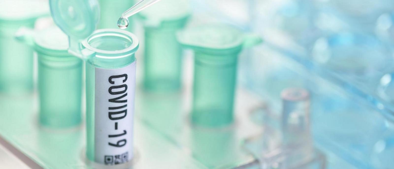 Coronavirus: vial with pipette in laboratory 