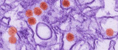 PNAS Publishes Zika Study from Racaniello and Vallee Labs | Pathology