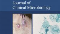 Journal of Clinical Microbiology November 2019 Journal of Clinical Microbiology November 2019